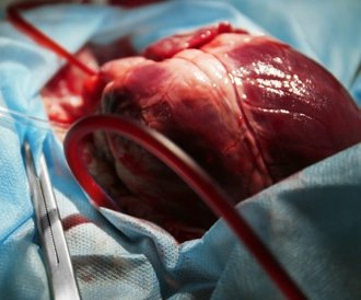 صور قلب مريض 12048 8