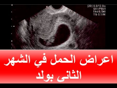 اعراض الحمل بولد في الشهور الاولى 12977