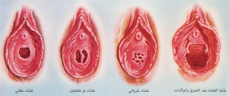 كيف اعرف اني عذراء- معلومات تهم كل بنت 3249 2