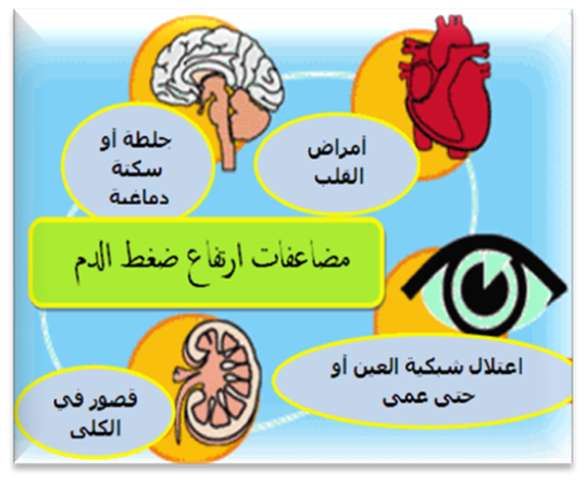 اسباب ارتفاع ضغط الدم - شرح اهم اسباب الضغط العالى 3964