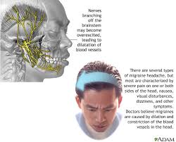 اسباب الصداع - مسببات الصداع القوي 323 3