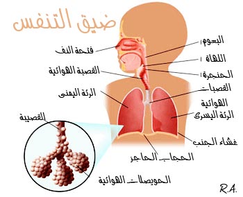 اسباب ضيق التنفس - واعراضة وطرق المختلفة لعلاجة 942 1