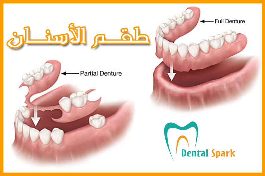 طقم اسنان - ثابت ومتحرك ومريح 879