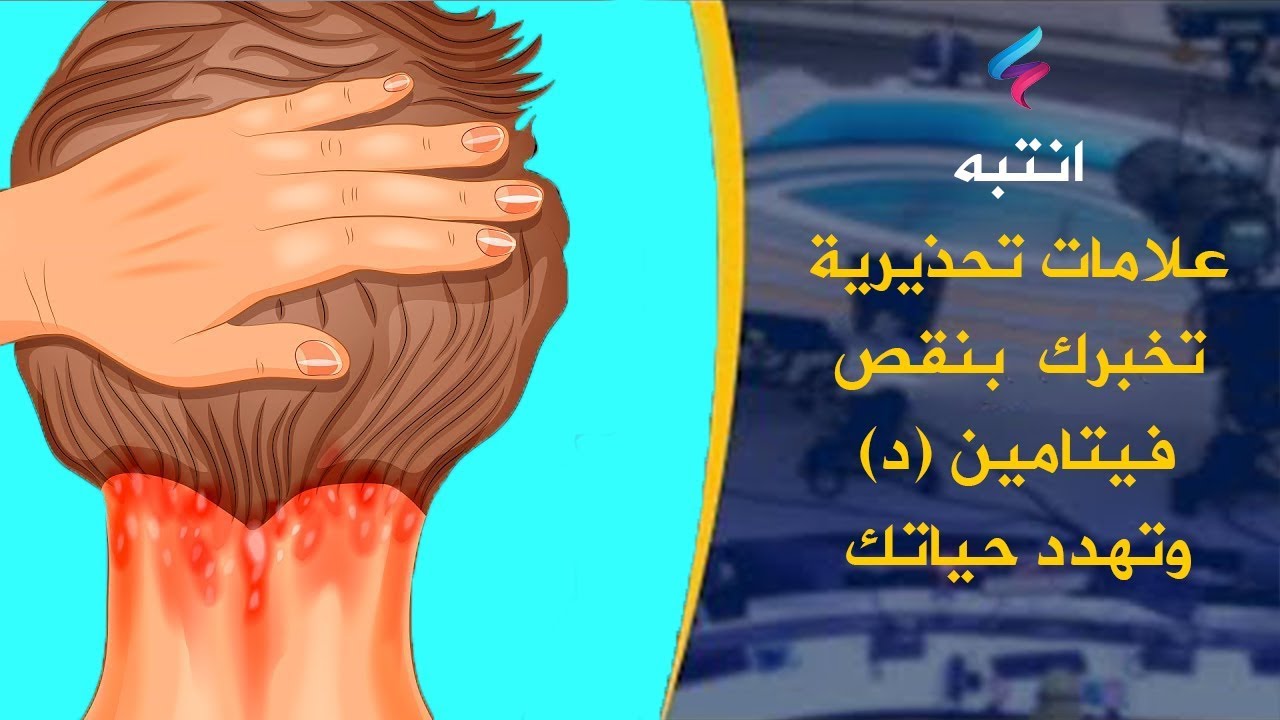 اعراض نقص فيتامين د , له الكثير من الأعراض