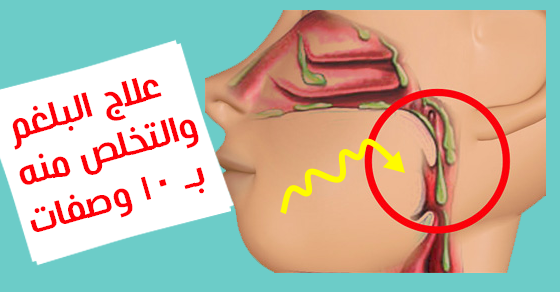 التخلص من البلغم , وصفات طبيعية للتخلص من البلغم