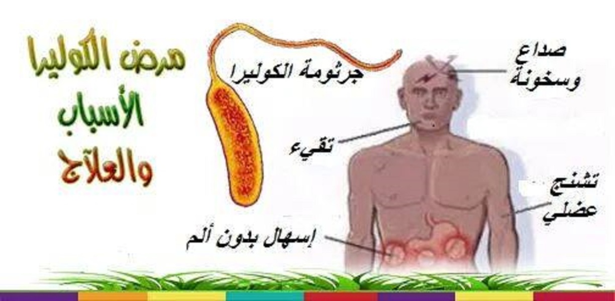 مرض الكوليرا - اعراض و علاج مرض الكوليرا 2086 2