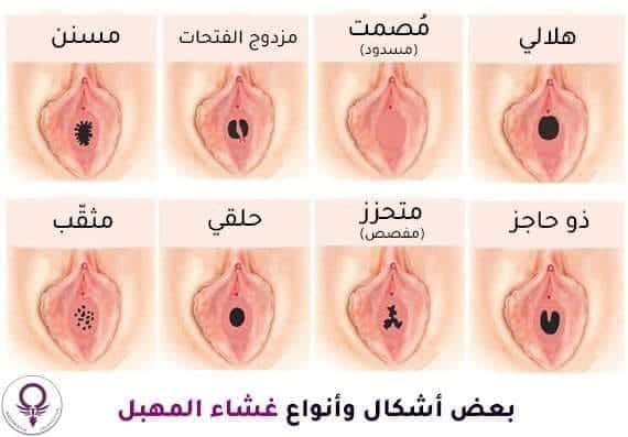 كيف تستمتعي وتمتعي زوجك ف الفراش - صور انواع المهبل 12231 2