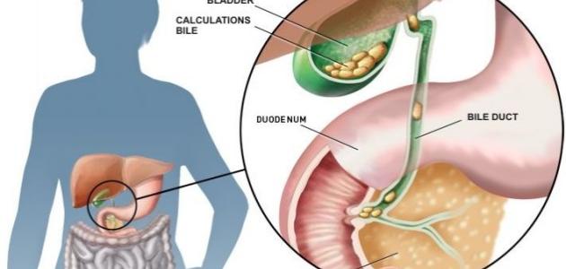 اعراض المرارة - ماهى اعراض مرض المراره - 3246 1