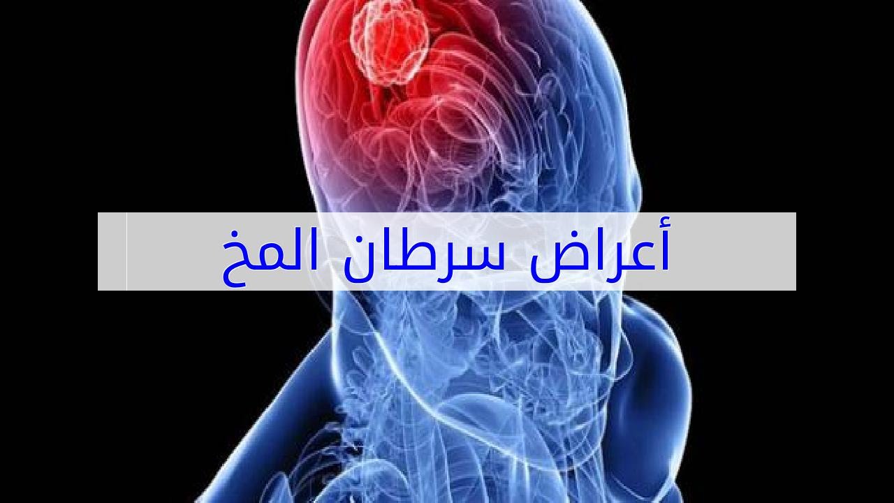 اعراض سرطان الدماغ - واحدث العلاجات لهذا المرض 3008 2