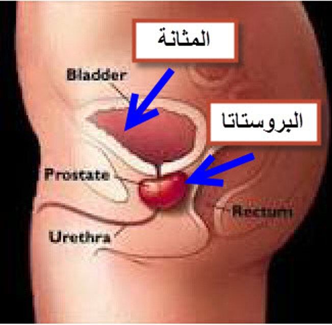 افضل مضاد حيوي لالتهاب البروستاتا 13072 3