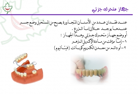 طقم اسنان - ثابت ومتحرك ومريح 879 5