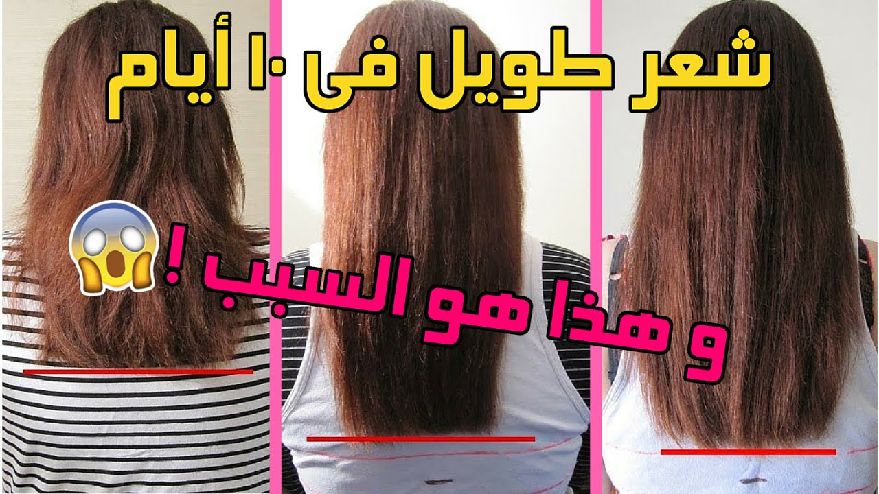 وصفات لتطويل الشعر، شعرك قصير حلك عندي 6142 10