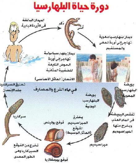 مرض البلهارسيا , اخطر واشهر الامراض