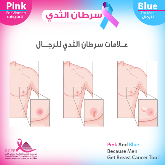 5143 1 اعراض سرطان الثدي - تعرفي على اعراض تشخيص مرض سرطان الثدي لدى النساء خواطر غالب