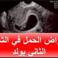 2667 3 علامات الحمل بولد في الشهر الثاني- معلومات عن الحمل فى ولد خواطر غالب